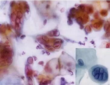 ���ϴ���ӣ��������ךW���M�ھ�ϴ�O���ꑌ�������Ҽ�